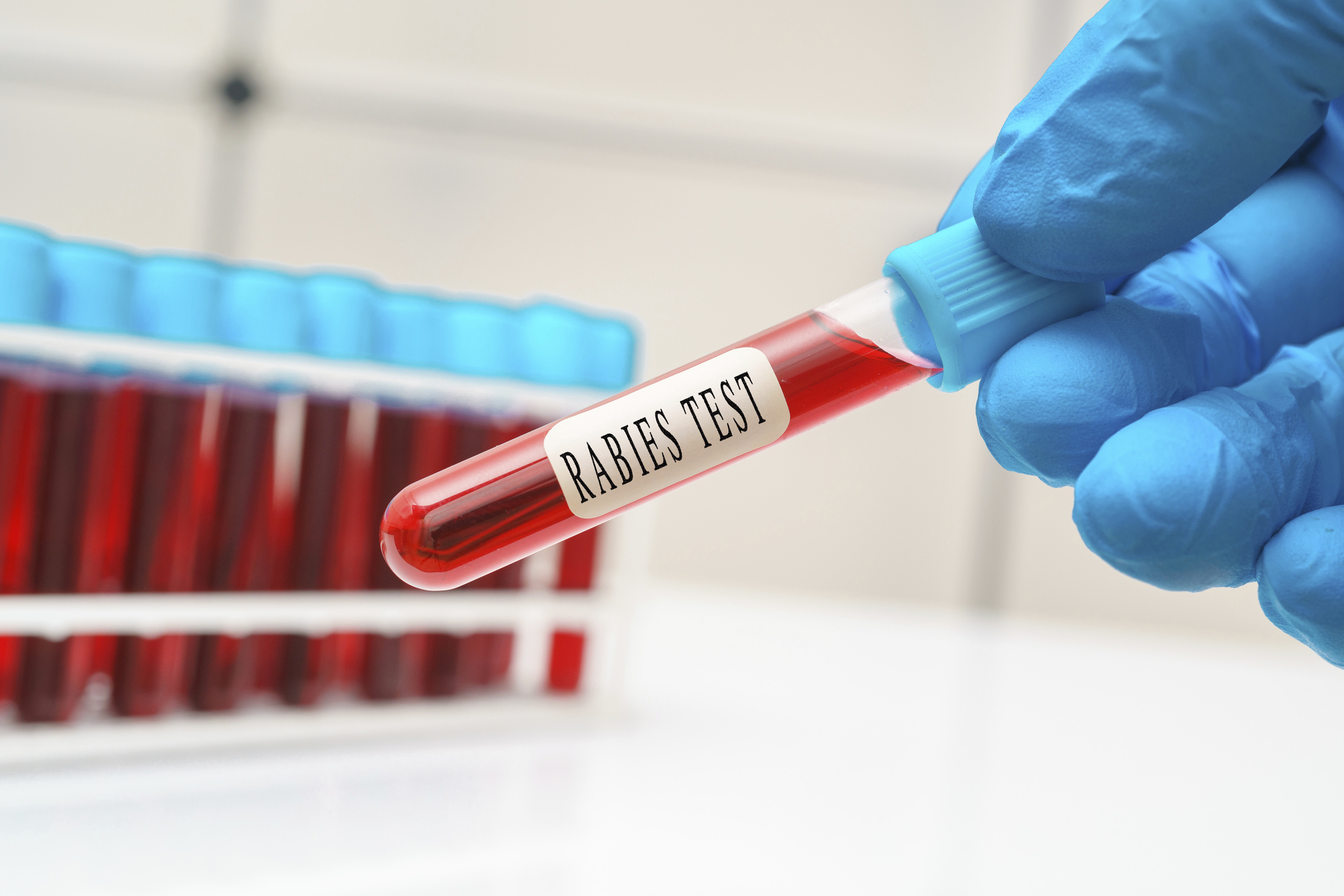 Rabies blood test, conceptual image.